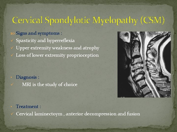 Cervical Spondylotic Myelopathy (CSM) Signs and symptoms : ü Spasticity and hyperreflexia ü Upper