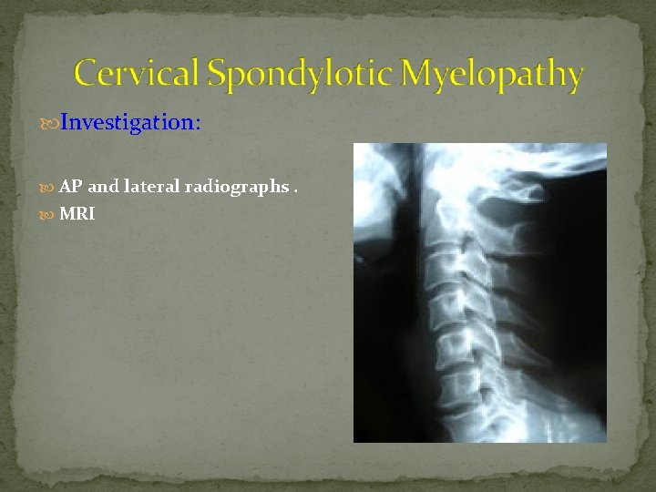  Investigation: AP and lateral radiographs. MRI 