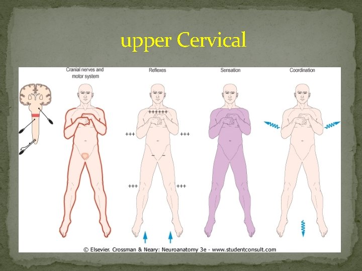  upper Cervical 