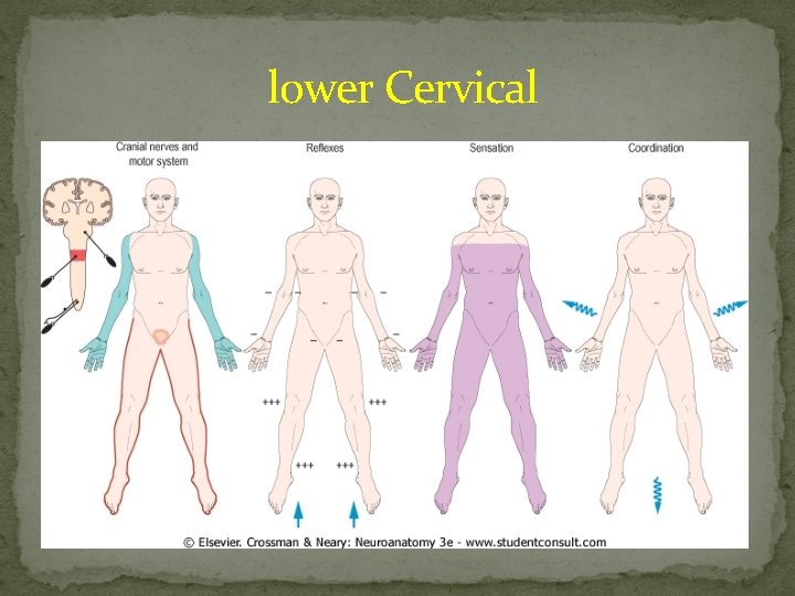  lower Cervical 