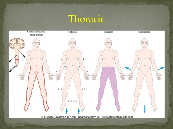 Thoracic 
