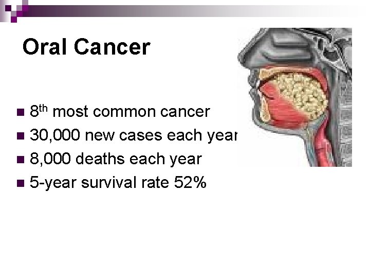 Oral Cancer 8 th most common cancer n 30, 000 new cases each year