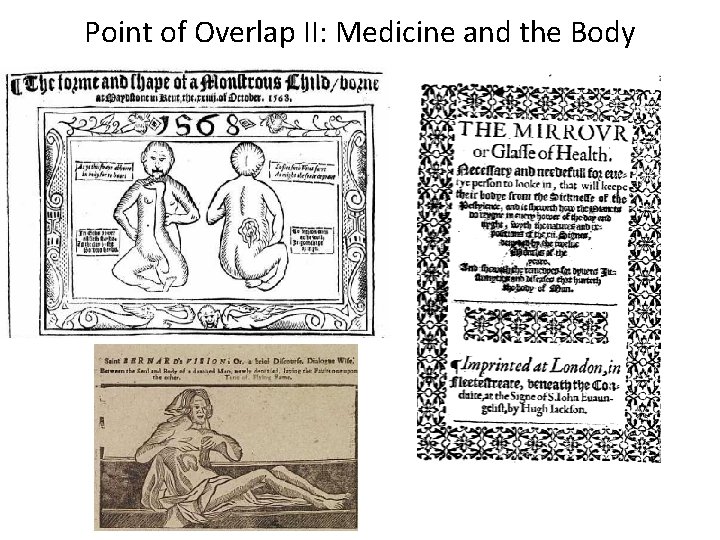 Point of Overlap II: Medicine and the Body Point of Overlap II: Medicine and the Body
