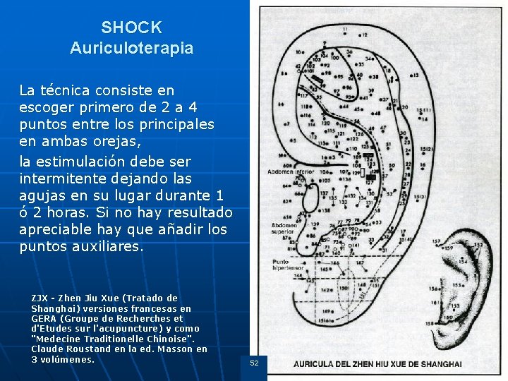 SHOCK Auriculoterapia La técnica consiste en escoger primero de 2 a 4 puntos entre