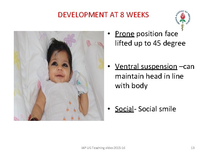 DEVELOPMENT AT 8 WEEKS • Prone position face lifted up to 45 degree •