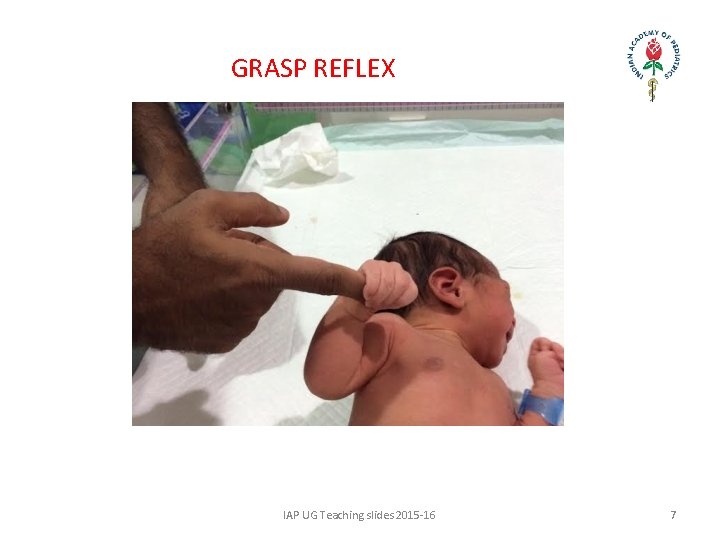 GRASP REFLEX IAP UG Teaching slides 2015 -16 7 