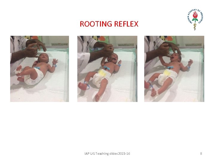 ROOTING REFLEX IAP UG Teaching slides 2015 -16 8 