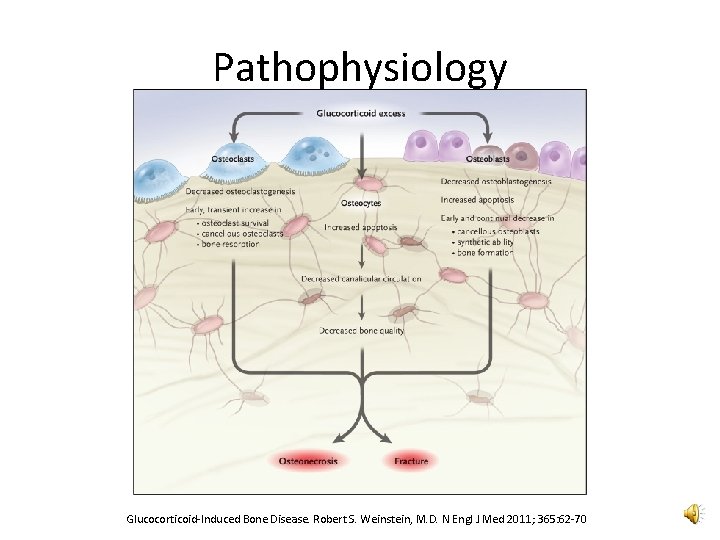 Pathophysiology Glucocorticoid-Induced Bone Disease. Robert S. Weinstein, M. D. N Engl J Med 2011;