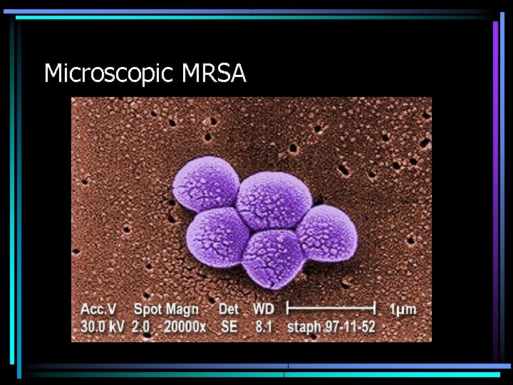 Microscopic MRSA 