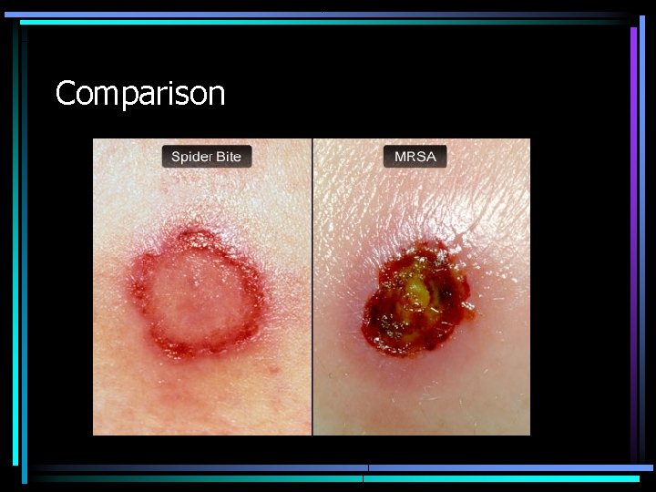 Comparison 