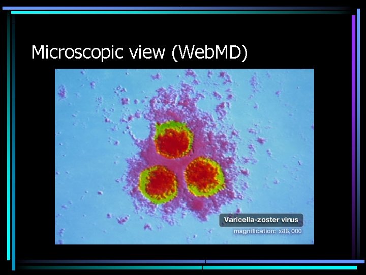 Microscopic view (Web. MD) 