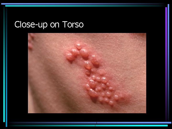 Close-up on Torso 