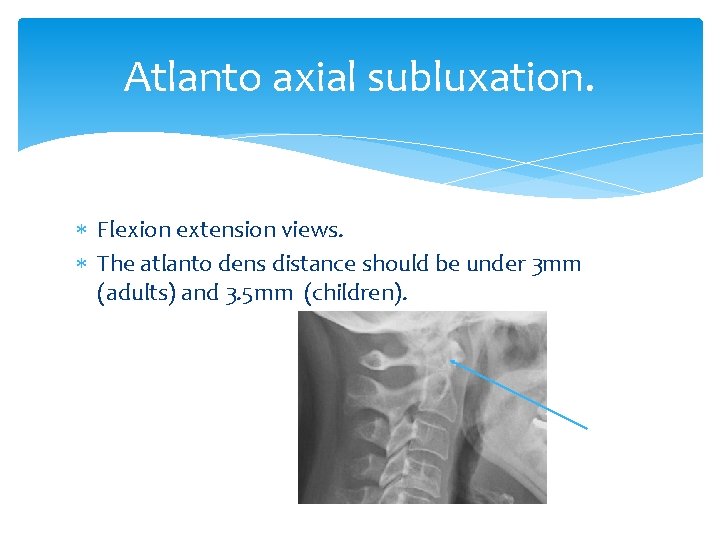 Atlanto axial subluxation. Flexion extension views. The atlanto dens distance should be under 3