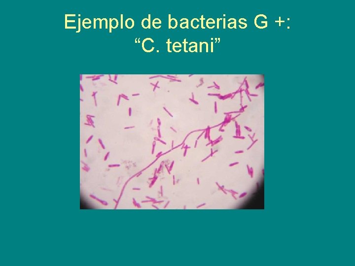 Ejemplo de bacterias G +: “C. tetani” 