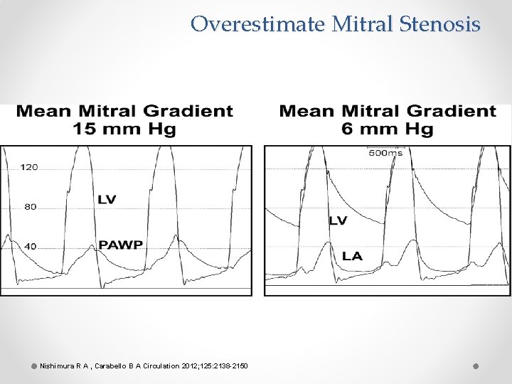 Overestimate Mitral Stenosis Nishimura R A , Carabello B A Circulation 2012; 125: 2138