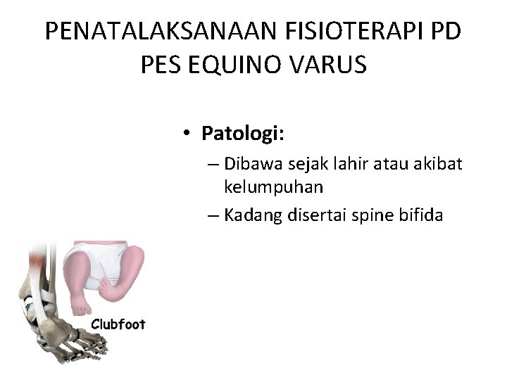PENATALAKSANAAN FISIOTERAPI PD PES EQUINO VARUS • Patologi: – Dibawa sejak lahir atau akibat