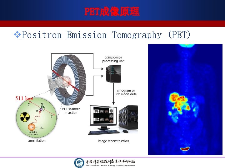 PET成像原理 v. Positron Emission Tomography (PET) 511 kev PET成像原理 v. Positron Emission Tomography (PET) 511 kev