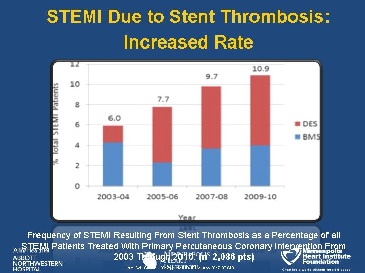 STEMI Due to Stent Thrombosis: Increased Rate Frequency of STEMI Resulting From Stent Thrombosis