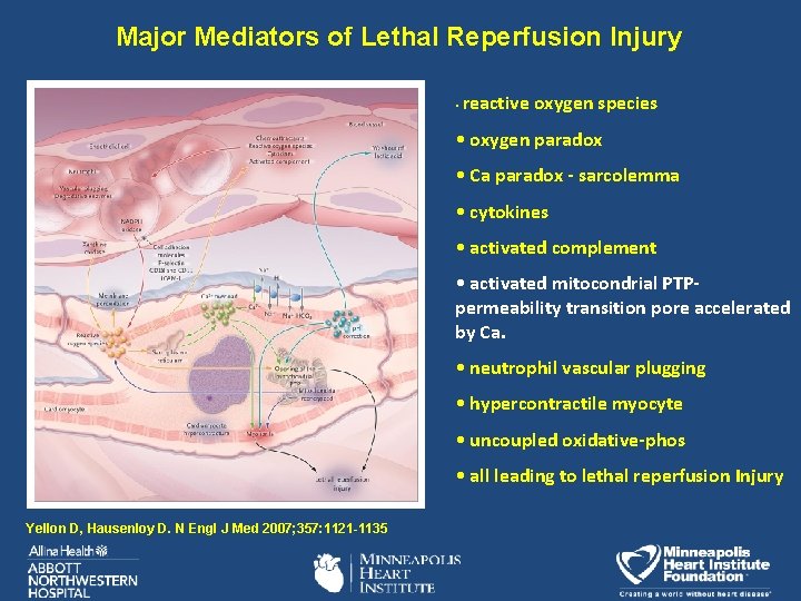 Major Mediators of Lethal Reperfusion Injury • reactive oxygen species • oxygen paradox •