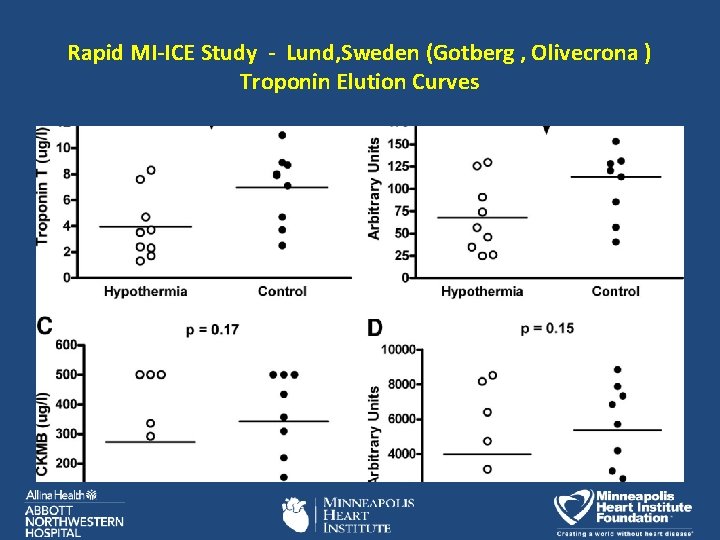 Rapid MI-ICE Study - Lund, Sweden (Gotberg , Olivecrona ) Troponin Elution Curves 