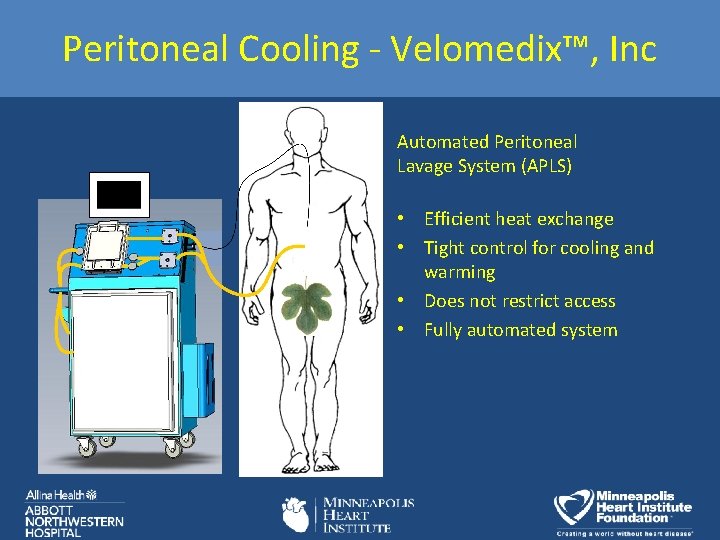 Peritoneal Cooling - Velomedix™, Inc Automated Peritoneal Lavage System (APLS) • Efficient heat exchange Peritoneal Cooling - Velomedix™, Inc Automated Peritoneal Lavage System (APLS) • Efficient heat exchange