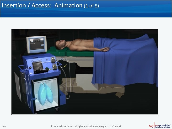 Insertion / Access: Animation (1 of 5) 40 © 2011 Velomedix, Inc. All rights