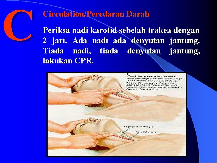 C Circulation/Peredaran Darah Periksa nadi karotid sebelah trakea dengan 2 jari. Ada nadi ada