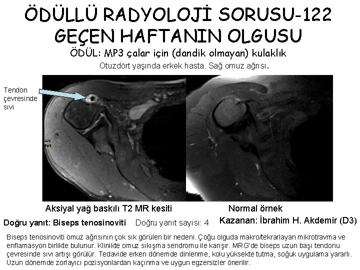 ÖDÜLLÜ RADYOLOJİ SORUSU-122 GEÇEN HAFTANIN OLGUSU ÖDÜL: MP 3 çalar için (dandik olmayan) kulaklık