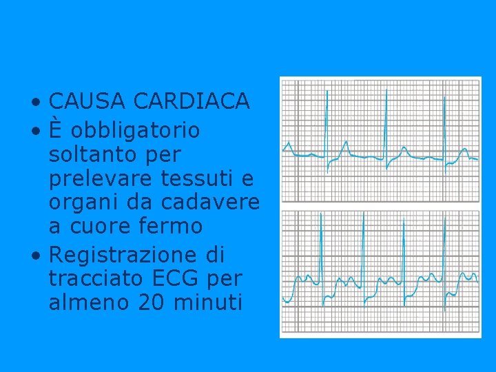  • CAUSA CARDIACA • È obbligatorio soltanto per prelevare tessuti e organi da