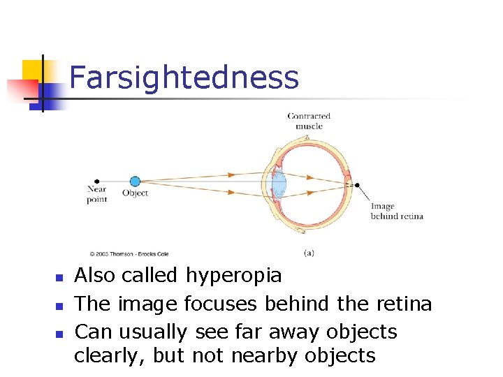 Farsightedness n n n Also called hyperopia The image focuses behind the retina Can