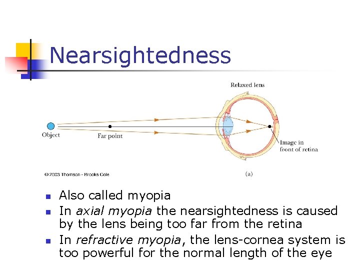 Nearsightedness n n n Also called myopia In axial myopia the nearsightedness is caused