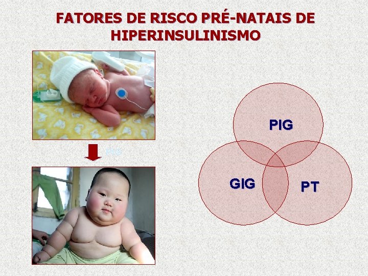 FATORES DE RISCO PRÉ-NATAIS DE HIPERINSULINISMO PIG GIG PT 