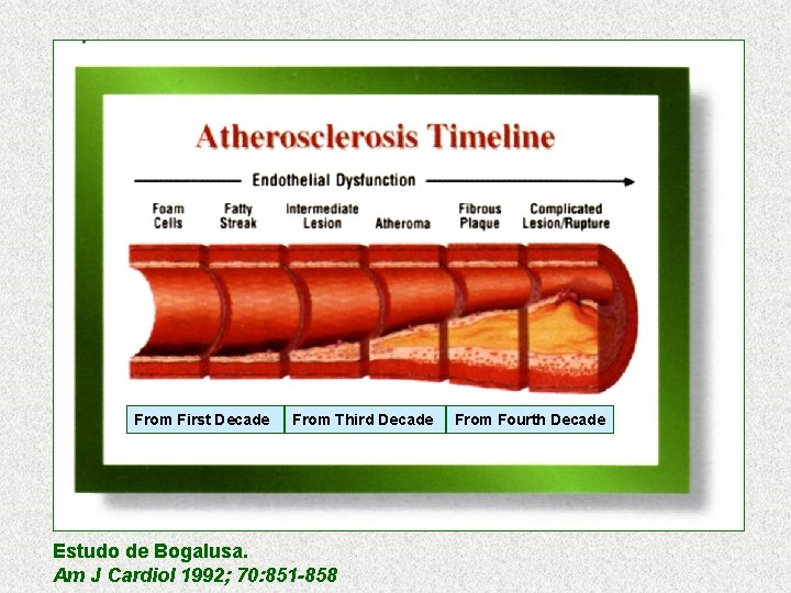 From First Decade From Third Decade Estudo de Bogalusa. Am J Cardiol 1992; 70: