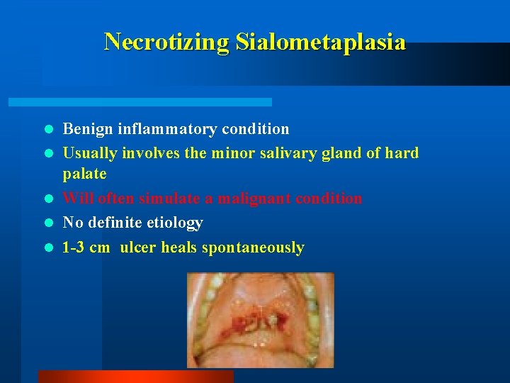 Necrotizing Sialometaplasia l l l Benign inflammatory condition Usually involves the minor salivary gland