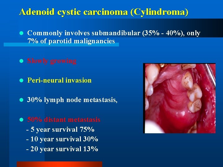 Adenoid cystic carcinoma (Cylindroma) l Commonly involves submandibular (35% - 40%), only 7% of