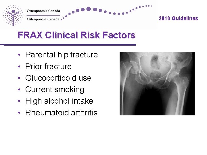 2010 Guidelines FRAX Clinical Risk Factors • • • Parental hip fracture Prior fracture