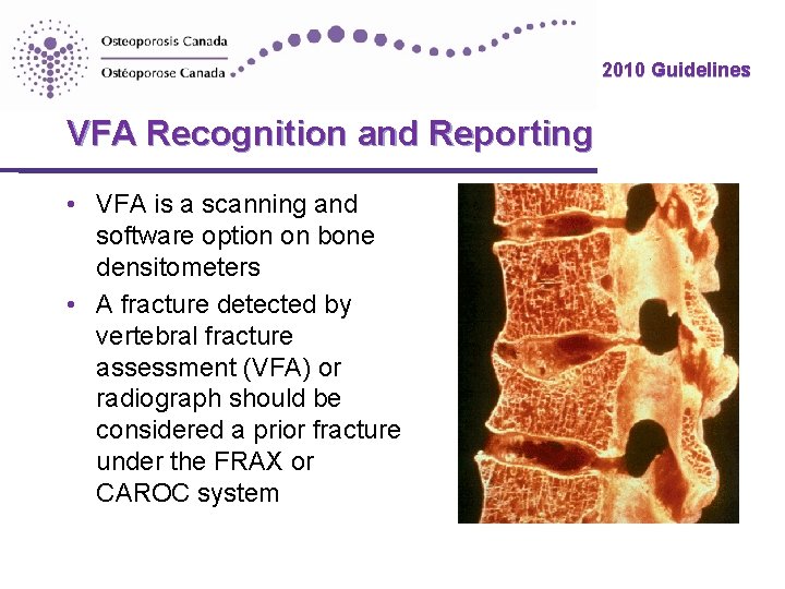 2010 Guidelines VFA Recognition and Reporting • VFA is a scanning and software option