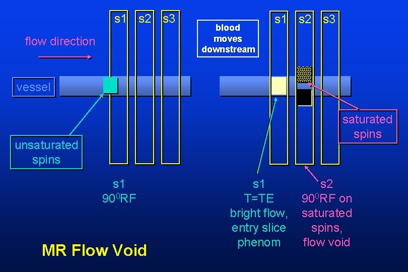 s 1 s 2 s 3 flow direction blood moves downstream s 1 s