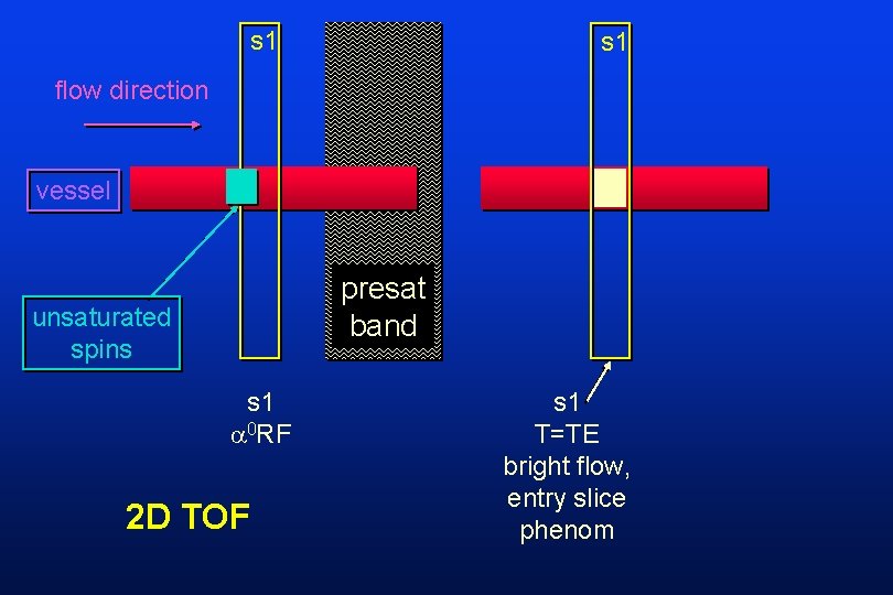 s 1 flow direction vessel presat band unsaturated spins s 1 0 RF 2
