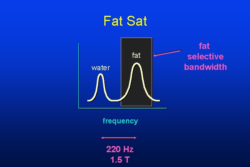 Fat Sat fat water frequency 220 Hz 1. 5 T fat selective bandwidth 