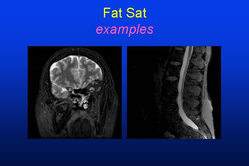Fat Sat examples 