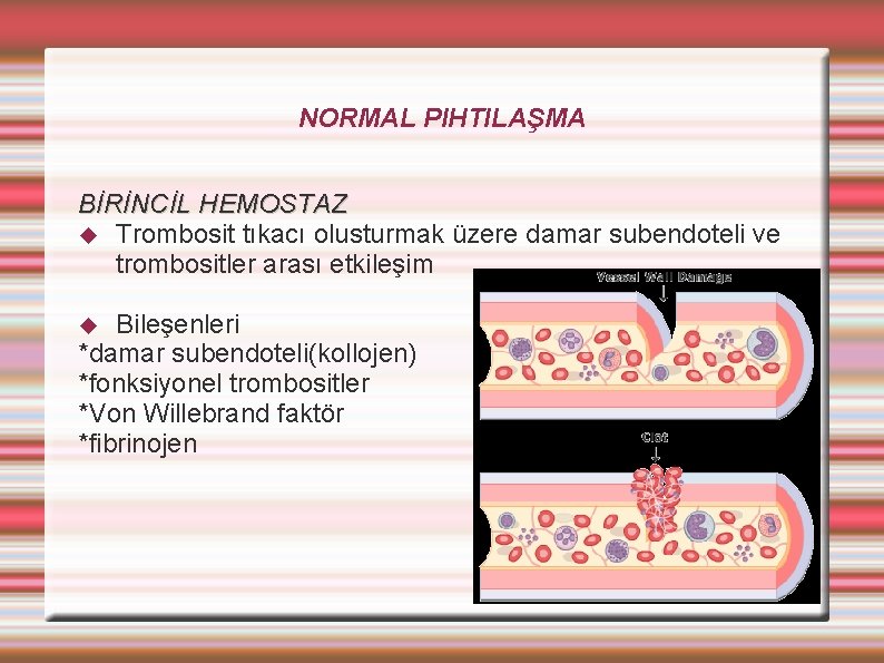 NORMAL PIHTILAŞMA BİRİNCİL HEMOSTAZ Trombosit tıkacı olusturmak üzere damar subendoteli ve trombositler arası etkileşim