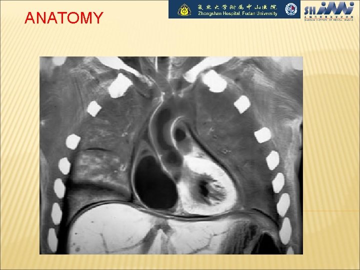 ANATOMY 