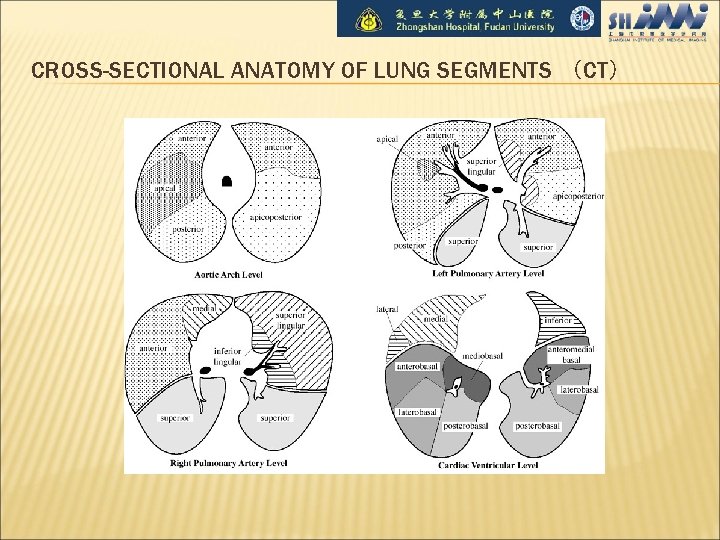 CROSS-SECTIONAL ANATOMY OF LUNG SEGMENTS （CT） 