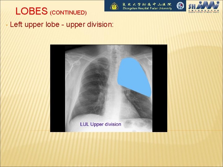 LOBES (CONTINUED) • Left upper lobe - upper division: 