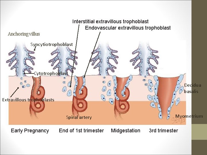 Interstitial extravillous trophoblast Endovascular extravillous trophoblast Anchoring villus Syncytiotrophoblast Cytotrophoblast Decidua basalis Extravillous trophoblasts
