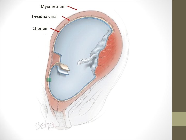 Myometrium Decidua vera Chorion 
