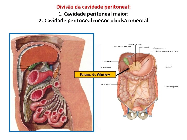 Divisão da cavidade peritoneal: 1. Cavidade peritoneal maior; 2. Cavidade peritoneal menor = bolsa