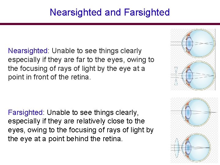 Nearsighted and Farsighted Nearsighted: Unable to see things clearly especially if they are far Nearsighted and Farsighted Nearsighted: Unable to see things clearly especially if they are far