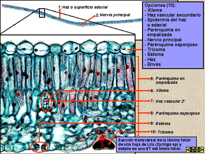 1: Haz o superficie adaxial 2: Nervio principal Opciones (10): - Xilema - Haz